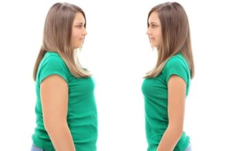 Obesity Weight Loss Concept 777x583 1 اكتشاف 14 جينًا جديدا يسبب زيادة الوزن يقدم أملا لتطوير عقاقير لعلاج السمنة مجلة نقطة العلمية