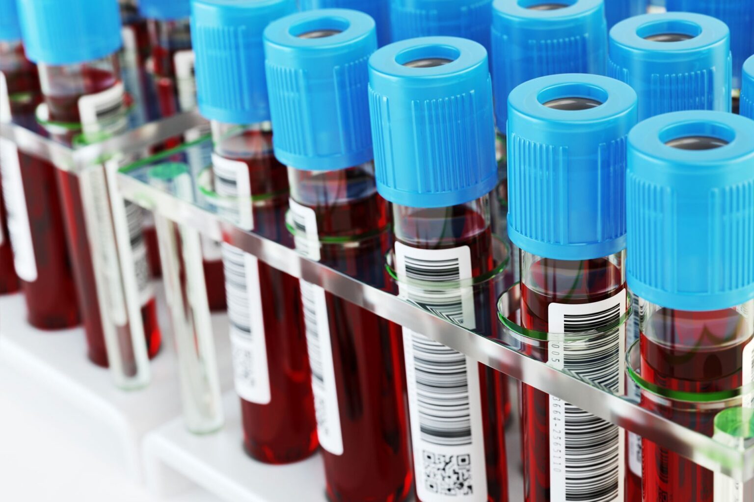 csm WEB AdobeStock 109044692 bfb4c4f71f باحثون يعثرون على علامات تحذير من الخرف في الدم مجلة نقطة العلمية