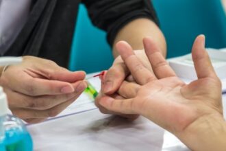 blood test cholesterol check انتبه: هذا هو أسوأ غذاء يسبب ارتفاع الكولسترول في الدم وفقا للخبراء! مجلة نقطة العلمية