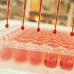 TestArrayWithRedLiquid 1024 علماء يكتشفون الارتباط الجيني بين نتائج فحص الدم واضطرابات الصحة العقلية مجلة نقطة العلمية