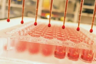 TestArrayWithRedLiquid 1024 علماء يكتشفون الارتباط الجيني بين نتائج فحص الدم واضطرابات الصحة العقلية مجلة نقطة العلمية