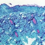 FAOVV7B6ZFLWDHFDKHOGC6SMNA اجتماع طارئ لمنظمة الصحة العالمية بعد تفشي جدري القرود مجلة نقطة العلمية