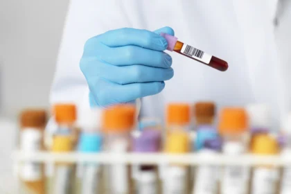 220614 blood test se 1227p 2ba56e ما مدى قوة مناعتك ضد مرض Covid-19؟ مجلة نقطة العلمية