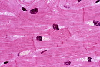 GettyImages 139826283 800x539 1 بعد بداية مبشرة لماذا فشلت زراعة قلب خنزير في جسم بشري؟ مجلة نقطة العلمية