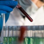 Vial of blood in laboratory 1200x628 1 تحذير: اختبارات الدم التي تكشف عن السرطان خطيرة! مجلة نقطة العلمية