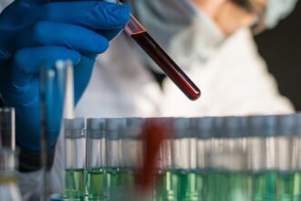 Vial of blood in laboratory 1200x628 1 تحذير: اختبارات الدم التي تكشف عن السرطان خطيرة! مجلة نقطة العلمية