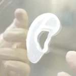 ear 2 لأول مرة في العالم.. زراعة "أذن حية" لمريضة تعاني من صغر الأذن "Microtia" مجلة نقطة العلمية