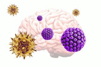 Low Res HSVAlzheimersDisease.gif الفيروسات الشائعة قد تكون سبب ظهور مرض الزهايمر مجلة نقطة العلمية