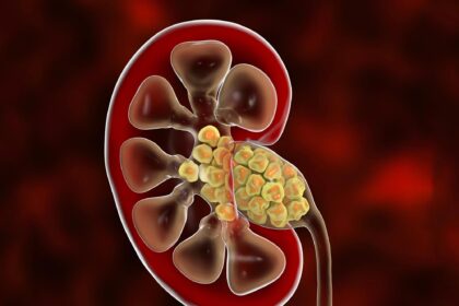 photo 2022 01 10 11 00 53 خدعة غذائية للمساعدة في منع حصوات الكلى مجلة نقطة العلمية