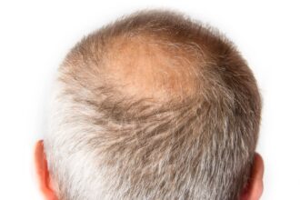 nok6a3 hair 3 خرافات شائعة عن تساقط الشعر ربما تعتقد بها مجلة نقطة العلمية