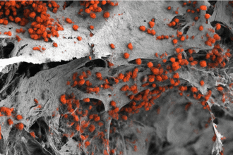 nok6anew lab made نموذج مبتكر لنخاع العظم في المختبر يمثل إنجازا هندسيا حيويا مجلة نقطة العلمية