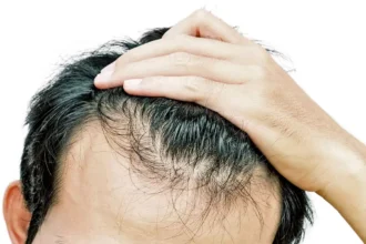 سبب تساقط الشعر عند سحبه ثلاث خرافات شائعة عن تساقط الشعر مجلة نقطة العلمية