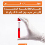 تحليل الغدة الدرقية تحليل الدم الطريقة "الوحيدة" لقياس هرمون الغدة الدرقية مجلة نقطة العلمية