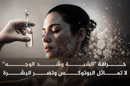 الشبه  خرافة "الشبة وشد الوجه" ليست بوتوكسا وتضر البشرة مجلة نقطة العلمية